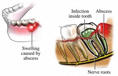 symptoms-dental-abscess-cats